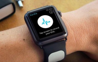 AliveCor重启Apple Watch反垄断诉讼，苹果再次胜诉！